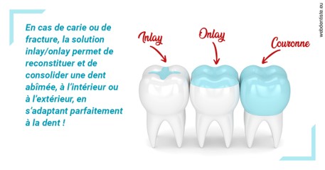 https://selarl-docteur-daniel-benichou.chirurgiens-dentistes.fr/L'INLAY ou l'ONLAY