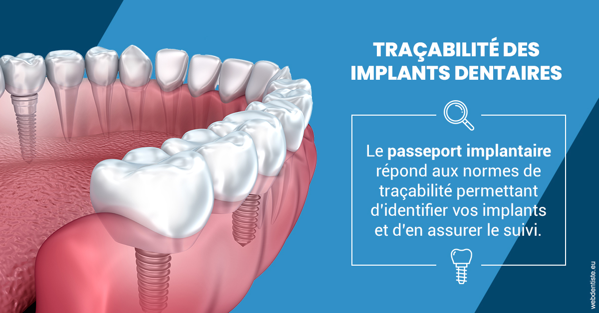 https://selarl-docteur-daniel-benichou.chirurgiens-dentistes.fr/T2 2023 - Traçabilité des implants 1