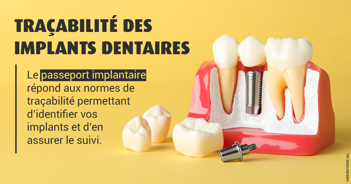 https://selarl-docteur-daniel-benichou.chirurgiens-dentistes.fr/T2 2023 - Traçabilité des implants 2