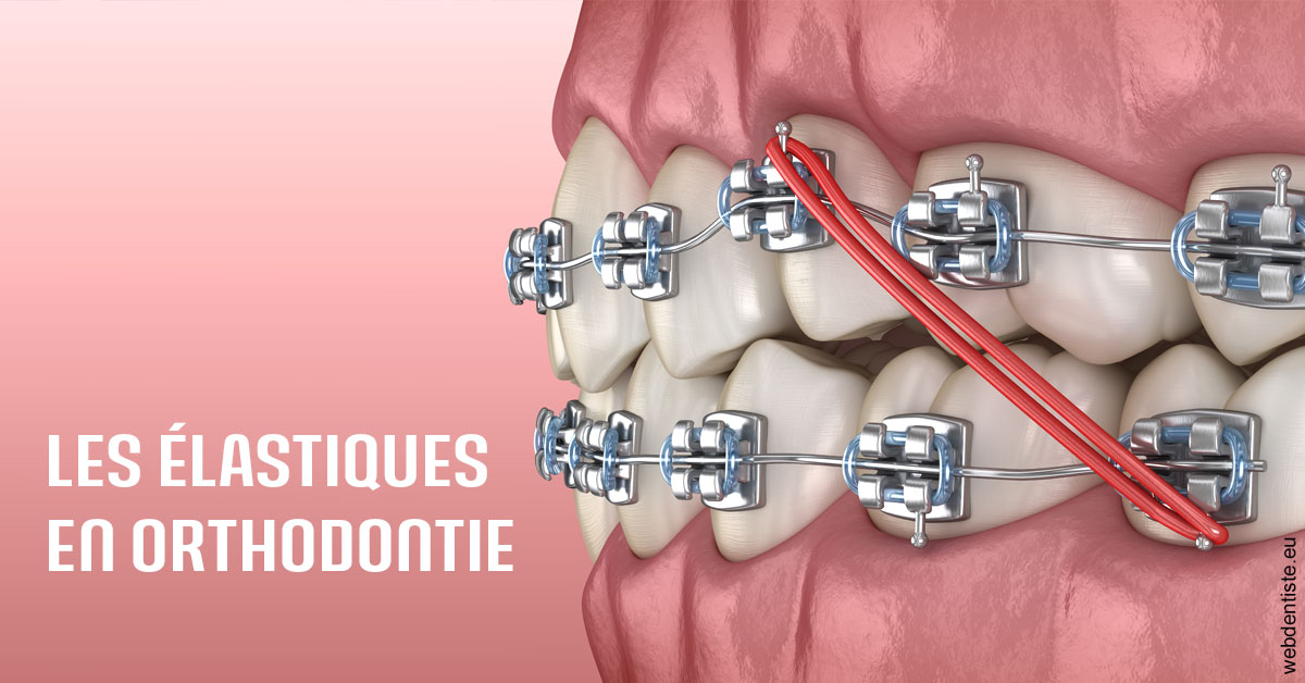 https://selarl-docteur-daniel-benichou.chirurgiens-dentistes.fr/Elastiques orthodontie 2