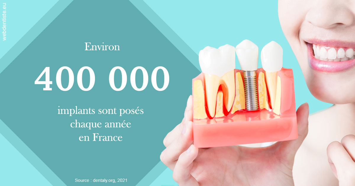 https://selarl-docteur-daniel-benichou.chirurgiens-dentistes.fr/Pose d'implants en France 2