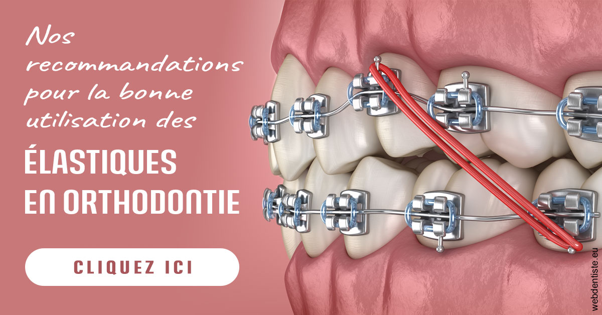 https://selarl-docteur-daniel-benichou.chirurgiens-dentistes.fr/Elastiques orthodontie 2